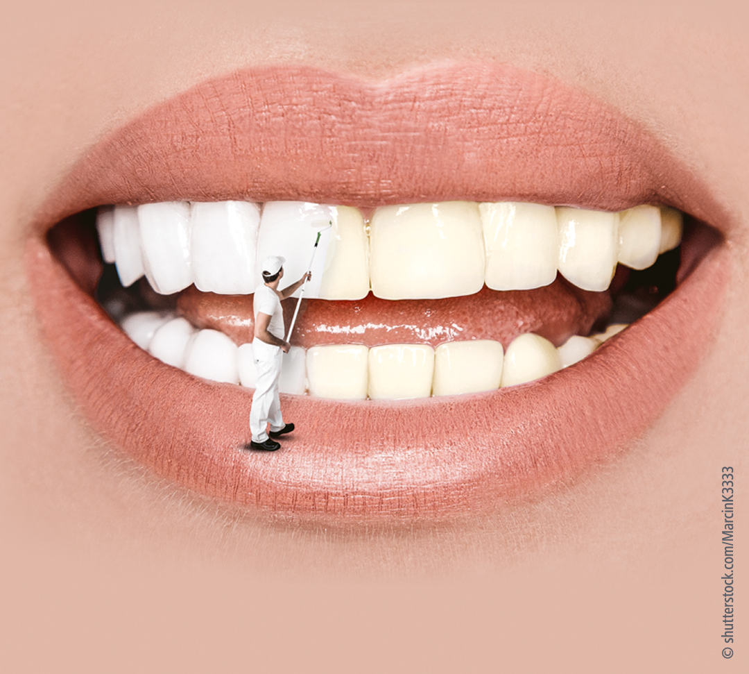 Bleaching-Aktion 